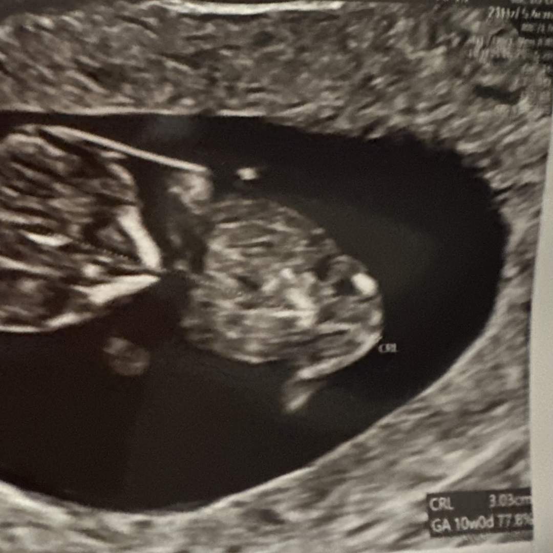 Photo shared by Annah for their Babylist baby registry.