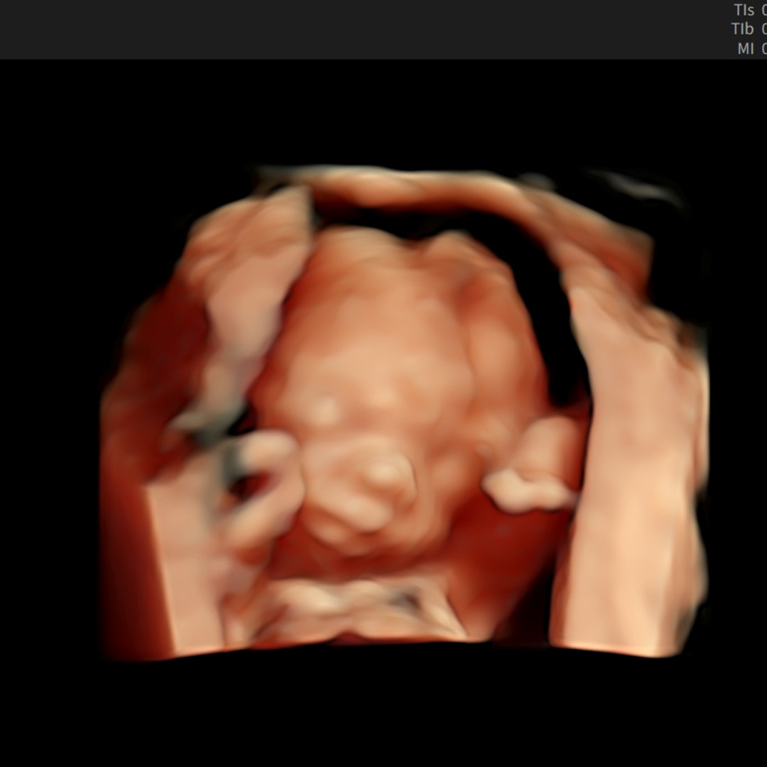 Photo shared by Jayla for their Babylist baby registry.