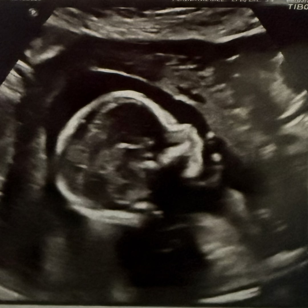 Photo shared by Sydney for their Babylist baby registry.