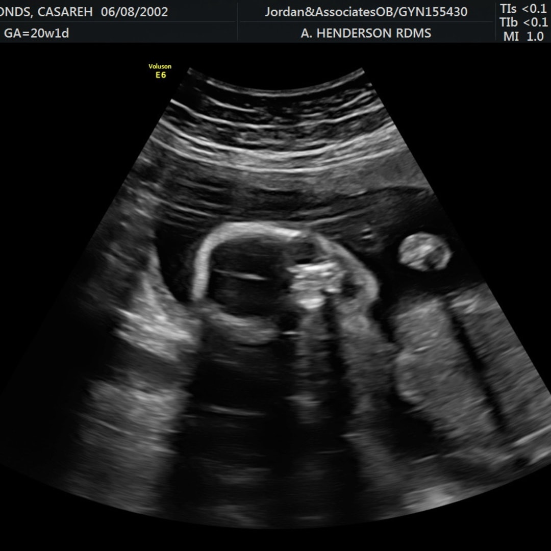 Photo shared by Caserah for their Babylist baby registry.