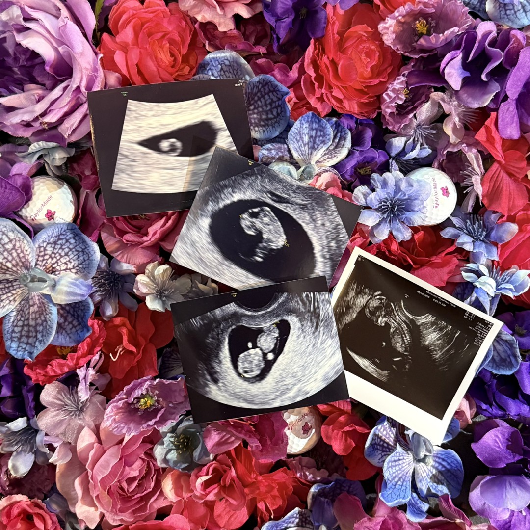 Photo shared by Rachael for their Babylist baby registry.