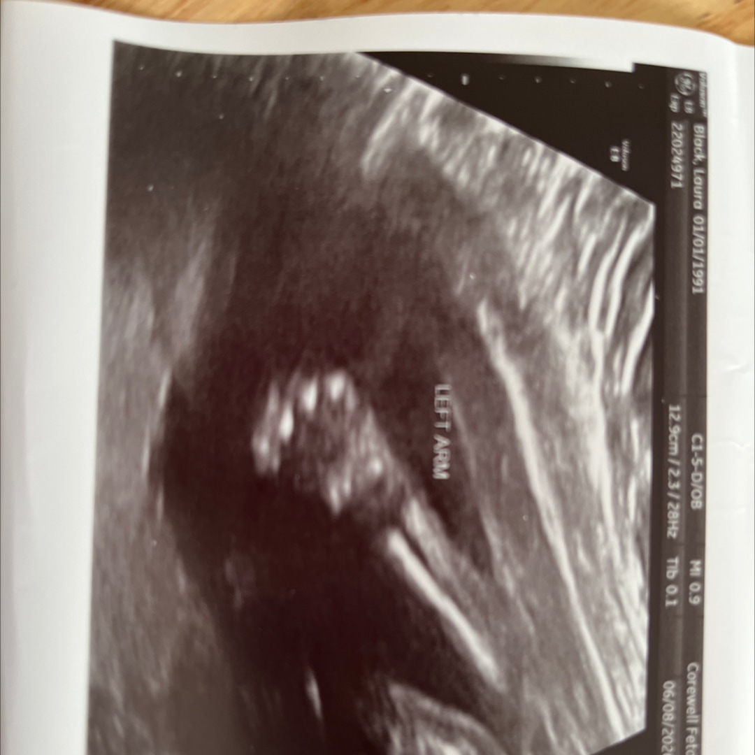 Photo shared by Laura for their Babylist baby registry.
