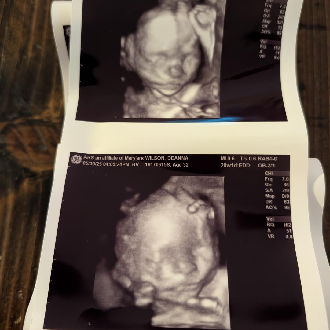 Photo shared by Deanna for their Babylist baby registry.