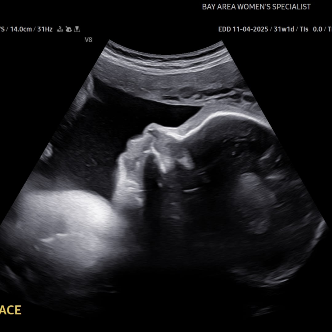 Photo shared by Haley for their Babylist baby registry.