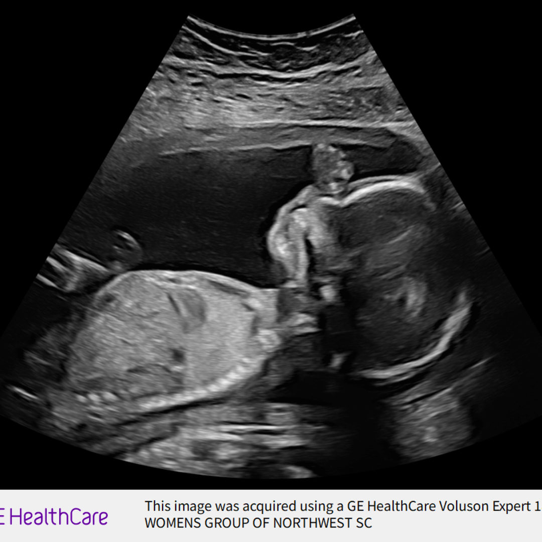 Photo shared by Jana for their Babylist baby registry.