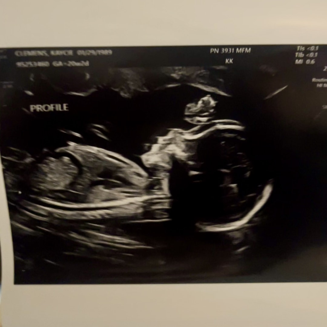 Photo shared by Christopher for their Babylist baby registry.