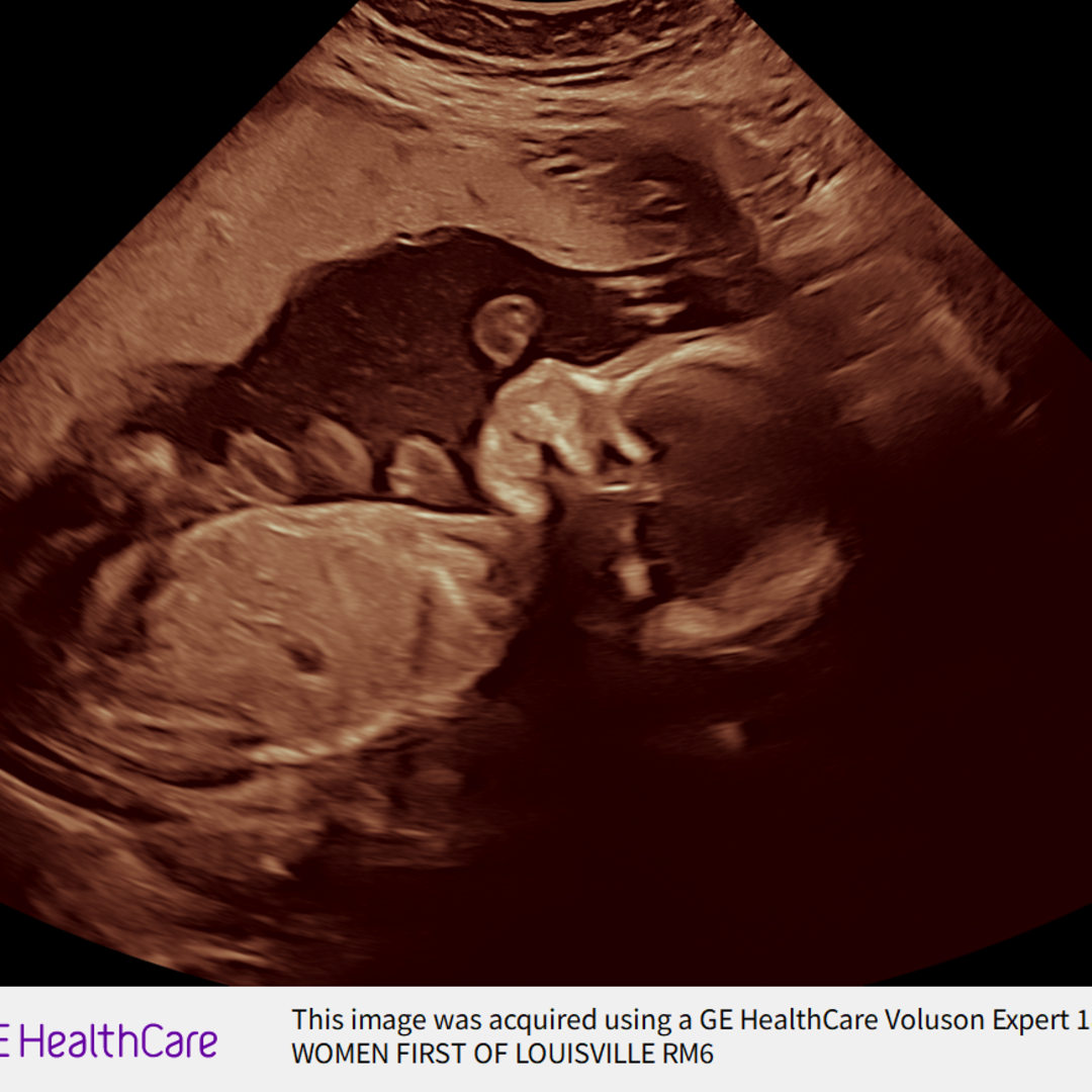 Photo shared by Hanna for their Babylist baby registry.