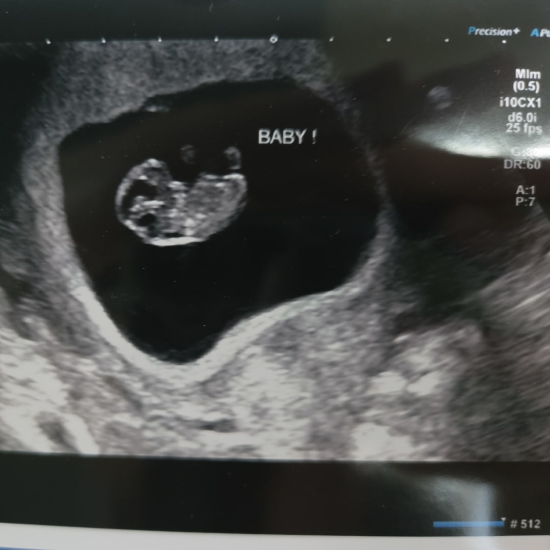 Photo shared by Assaf & Megan for their Babylist baby registry.