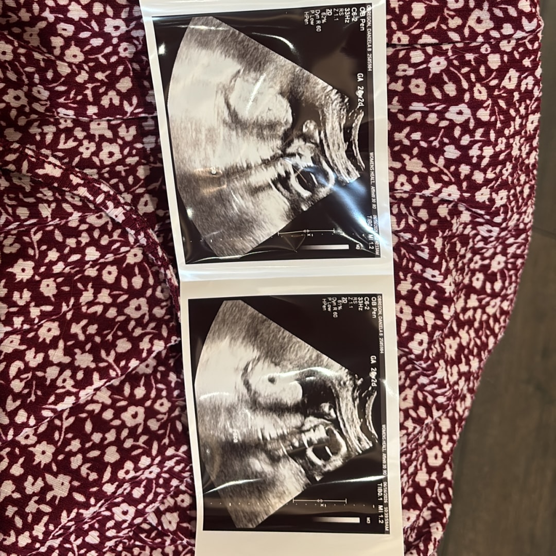 Photo shared by Daniela for their Babylist baby registry.