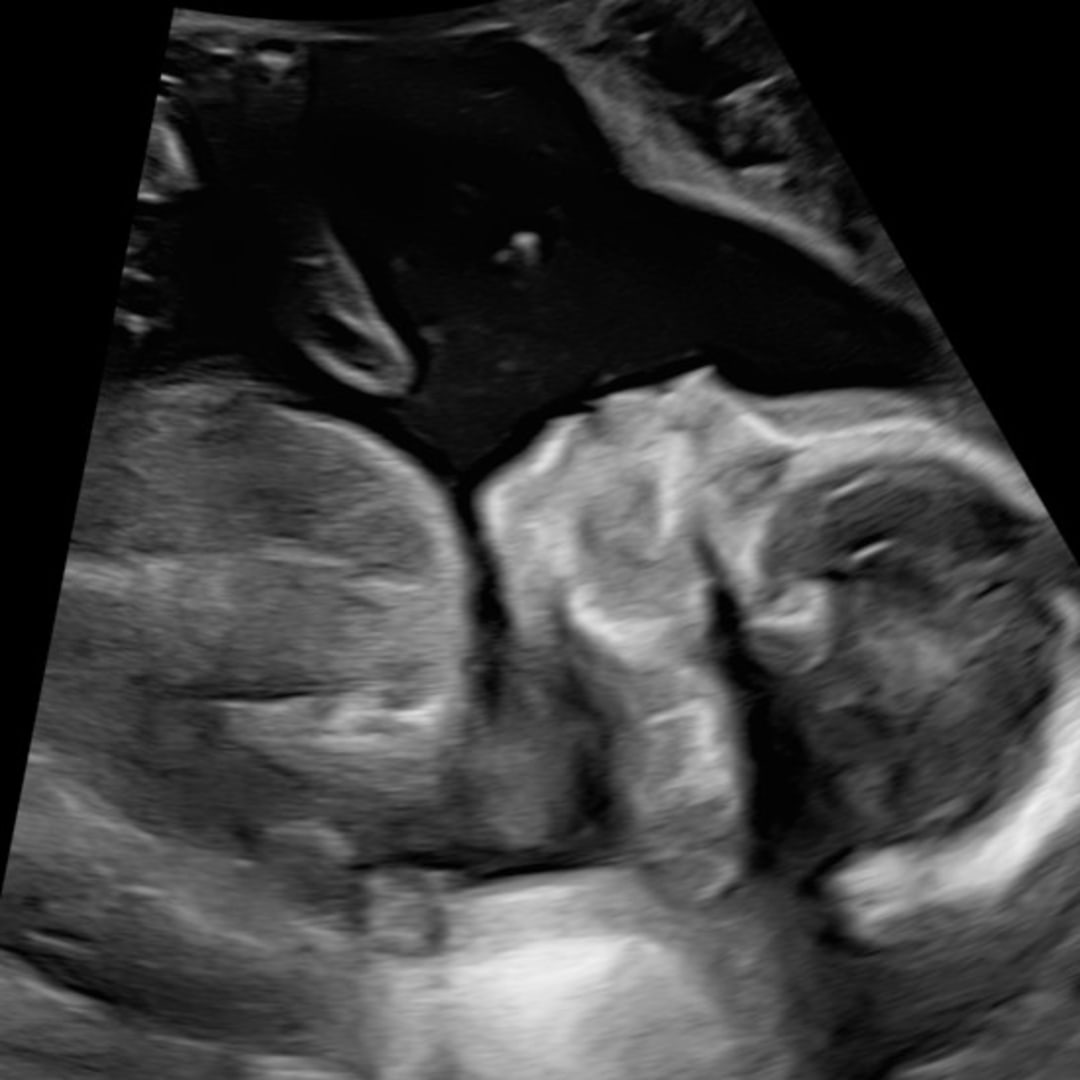 Photo shared by Alexa for their Babylist baby registry.