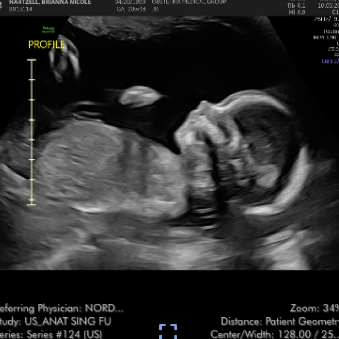 Photo shared by Brianna for their Babylist baby registry.