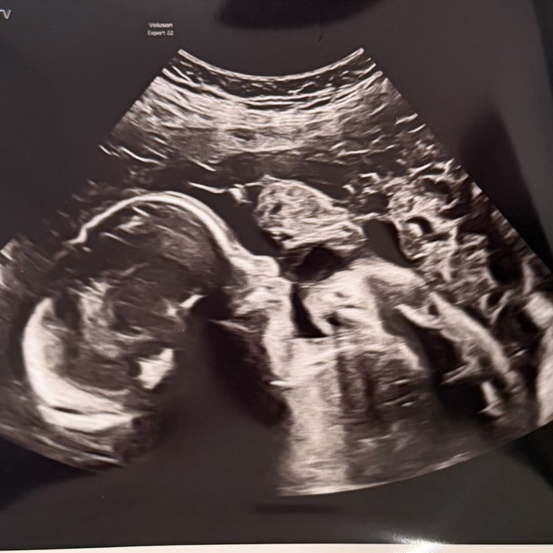 Photo shared by Kelly for their Babylist baby registry.