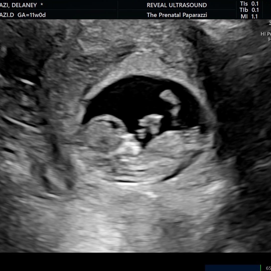 Photo shared by Delaney for their Babylist baby registry.