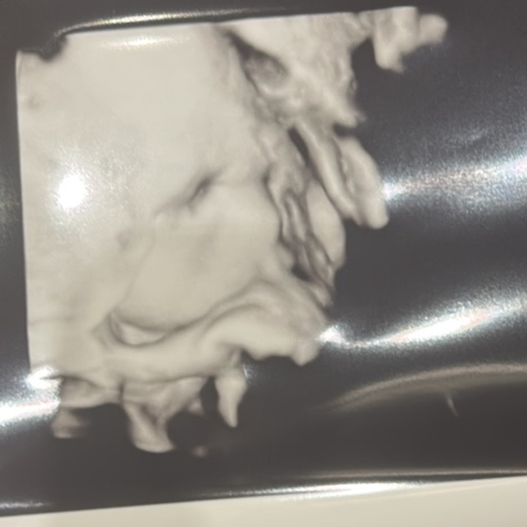 Photo shared by Georgia for their Babylist baby registry.