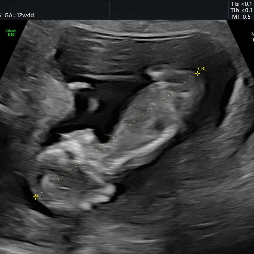 Photo shared by Kaytlyn for their Babylist baby registry.