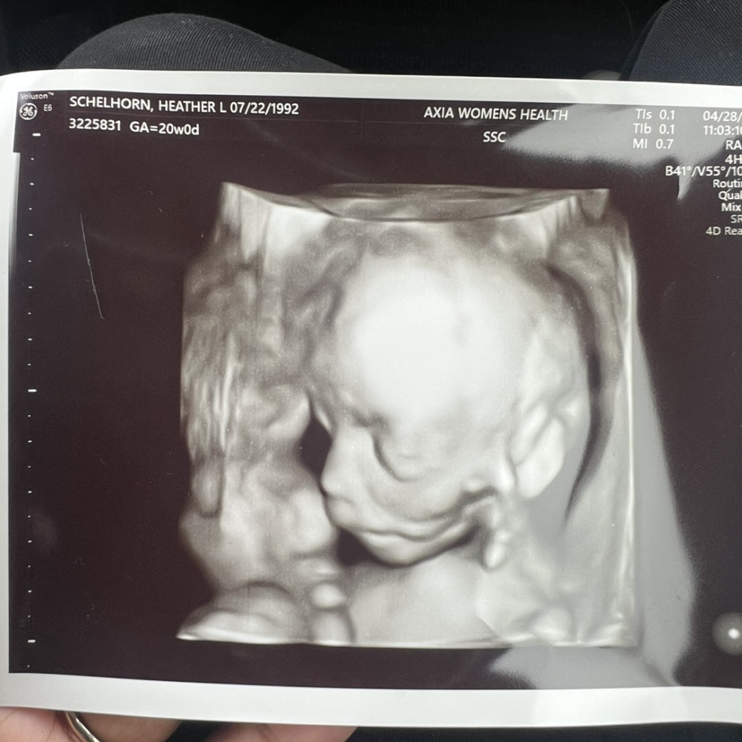 Photo shared by Heather for their Babylist baby registry.