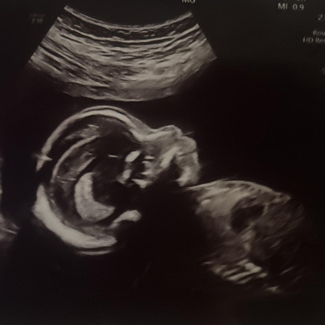 Photo shared by Leyla for their Babylist baby registry.
