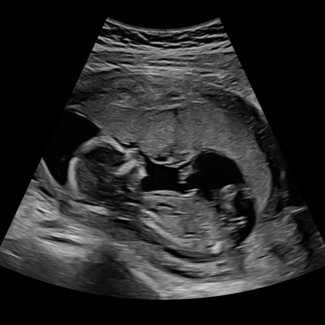 Photo shared by Emily for their Babylist baby registry.