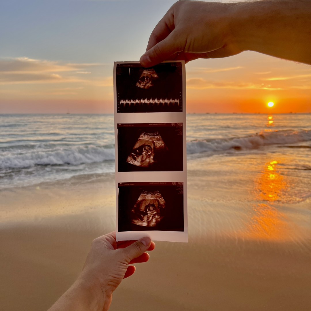 Photo shared by Ashley for their Babylist baby registry.