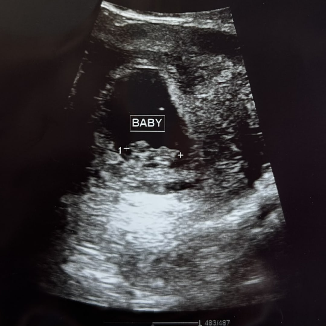 Photo shared by Alyssa for their Babylist baby registry.
