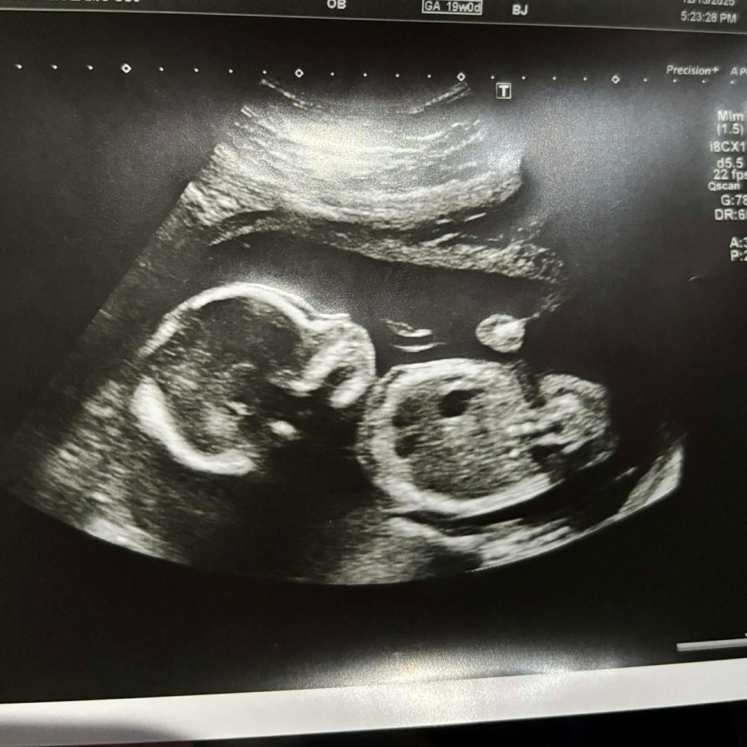 Photo shared by Michelle for their Babylist baby registry.