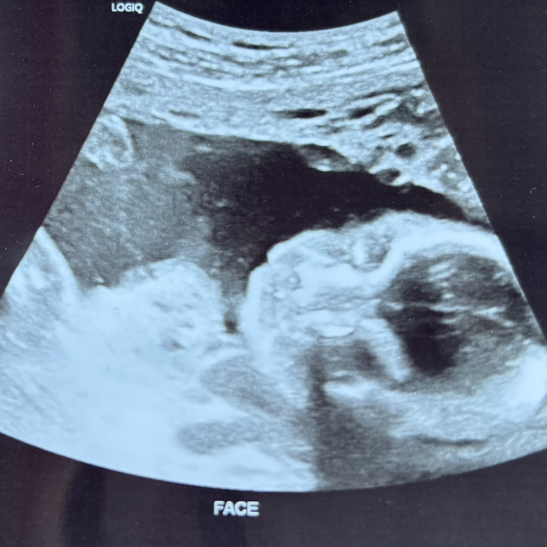 Photo shared by Amayia for their Babylist baby registry.