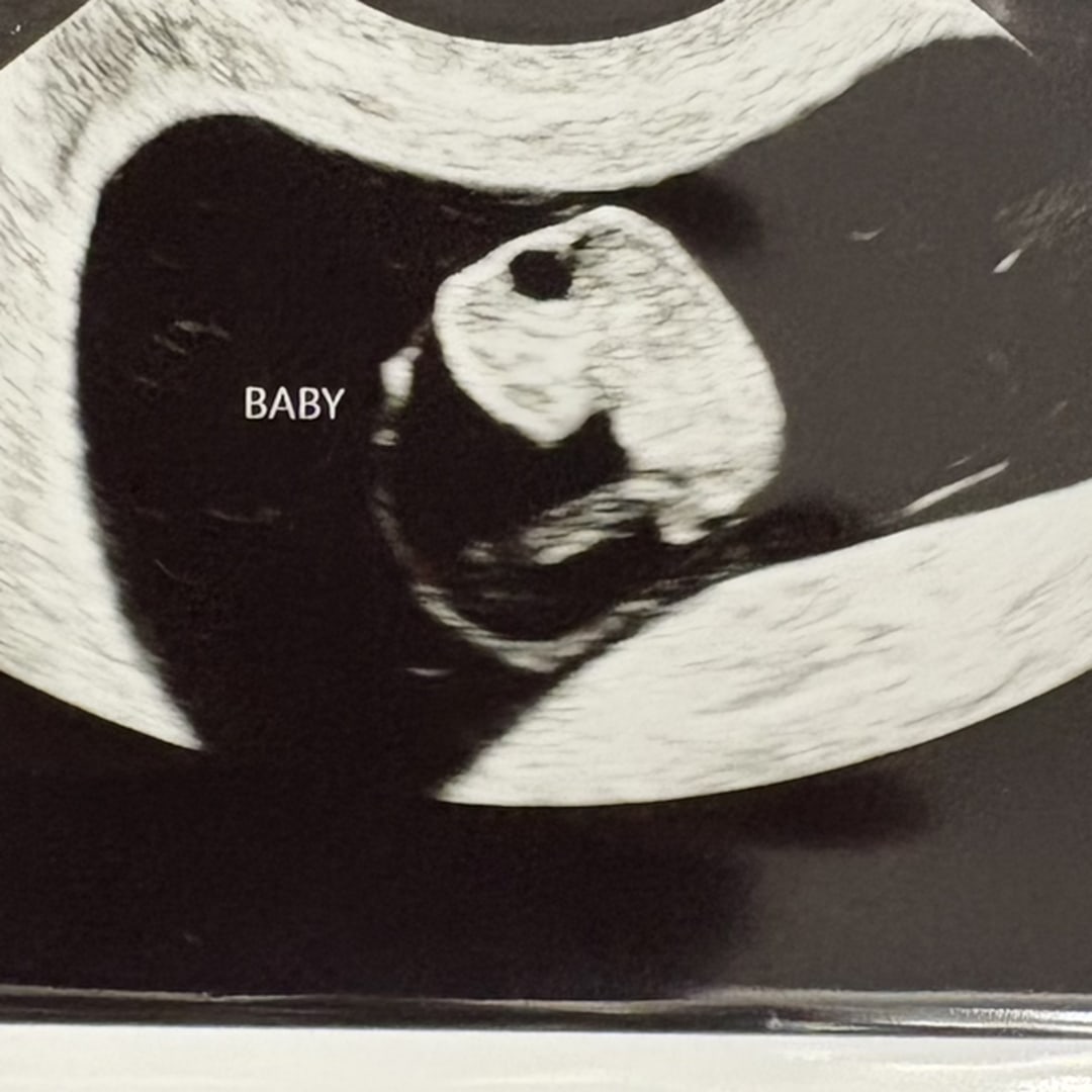 Photo shared by Cynaya for their Babylist baby registry.