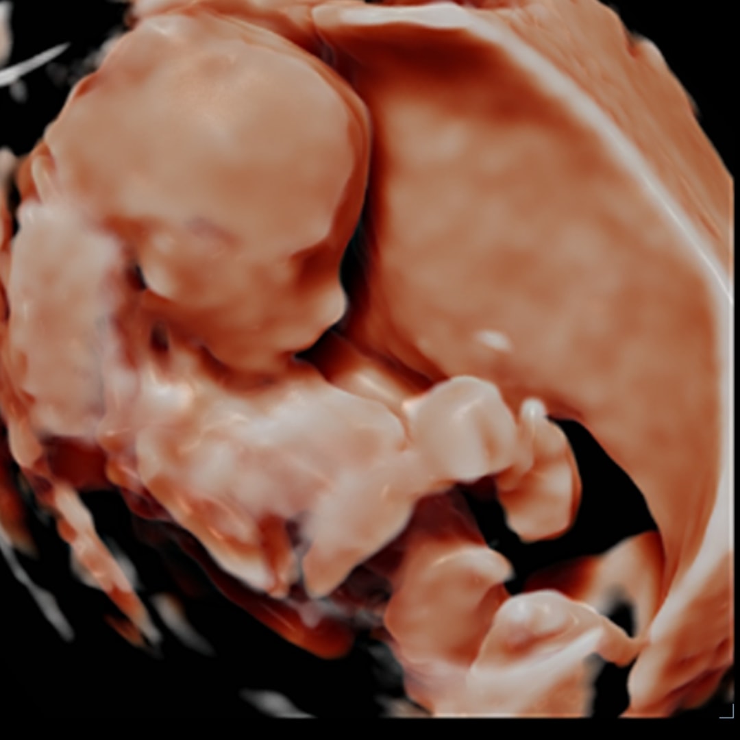 Photo shared by Anna for their Babylist baby registry.