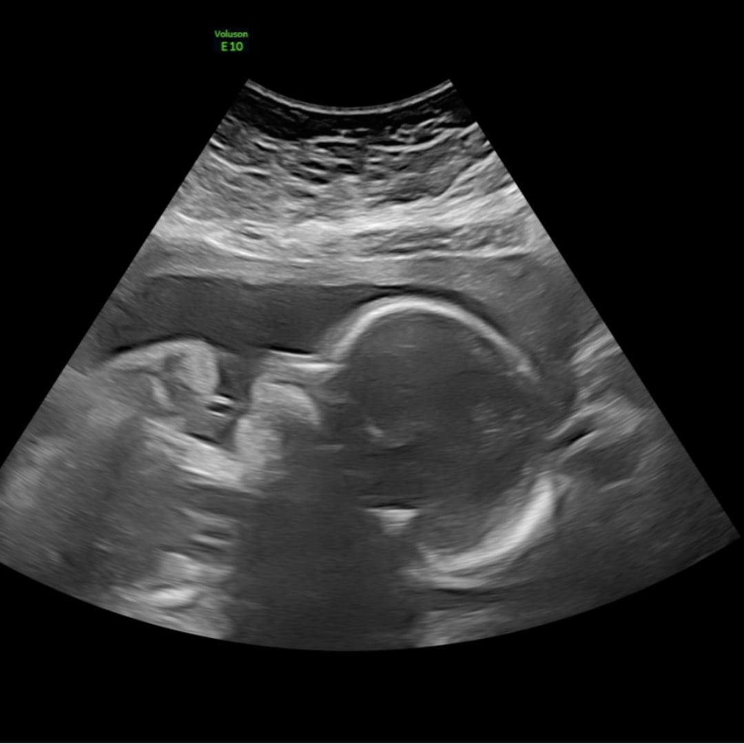 Photo shared by Kassandra for their Babylist baby registry.