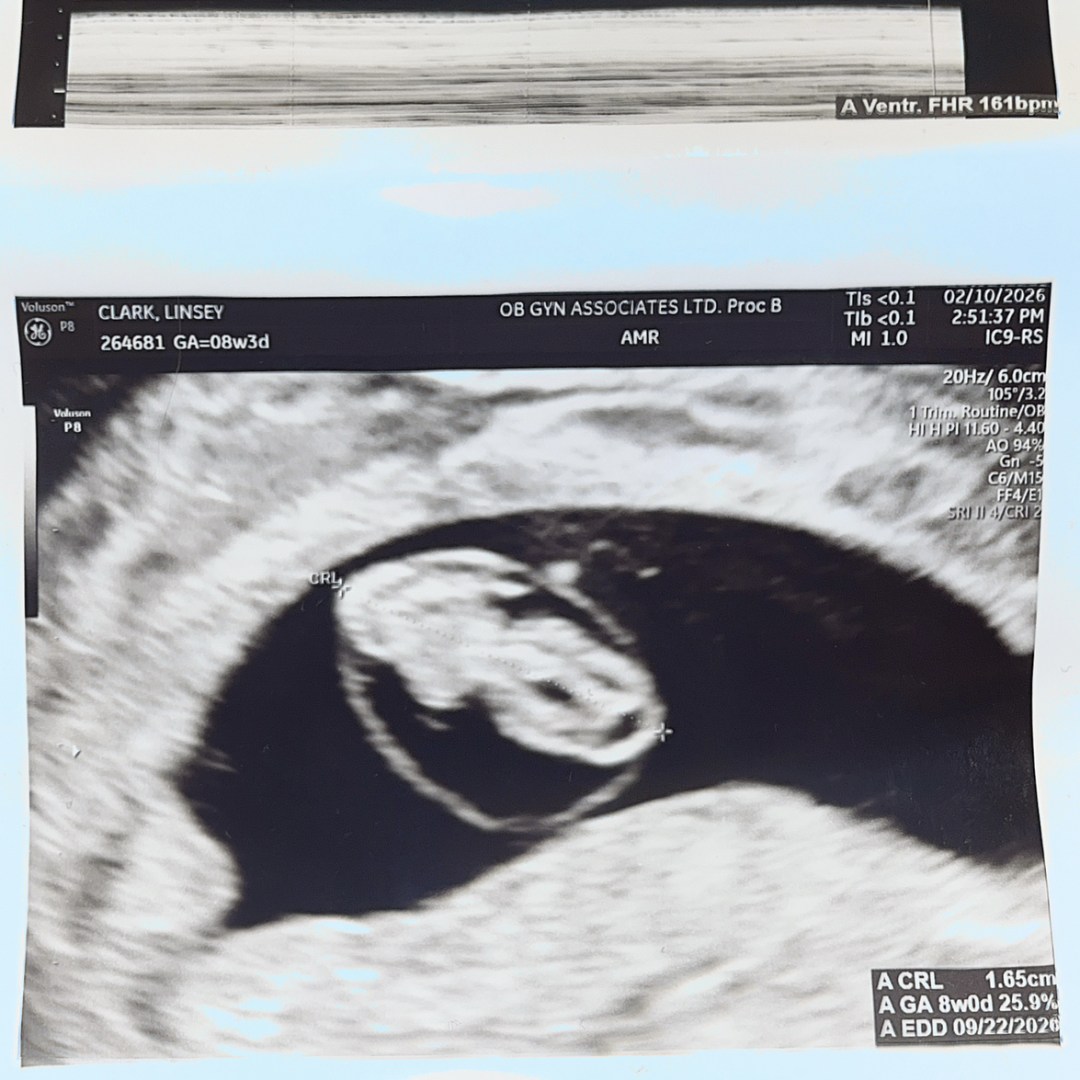 Photo shared by Linsey for their Babylist baby registry.