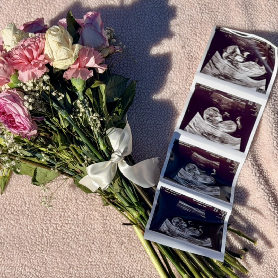 Photo shared by Meagan for their Babylist baby registry.