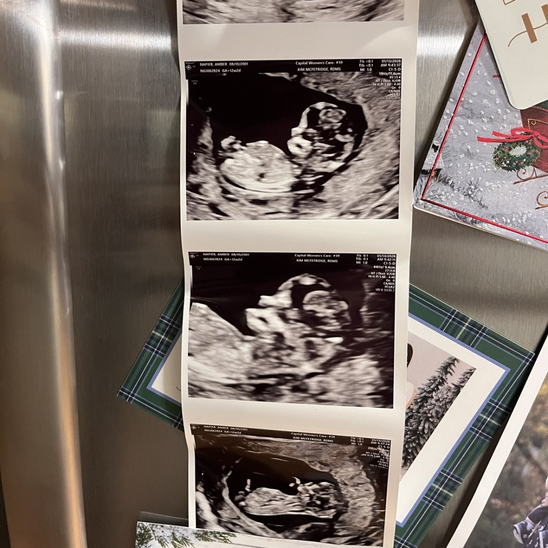 Photo shared by Amber for their Babylist baby registry.