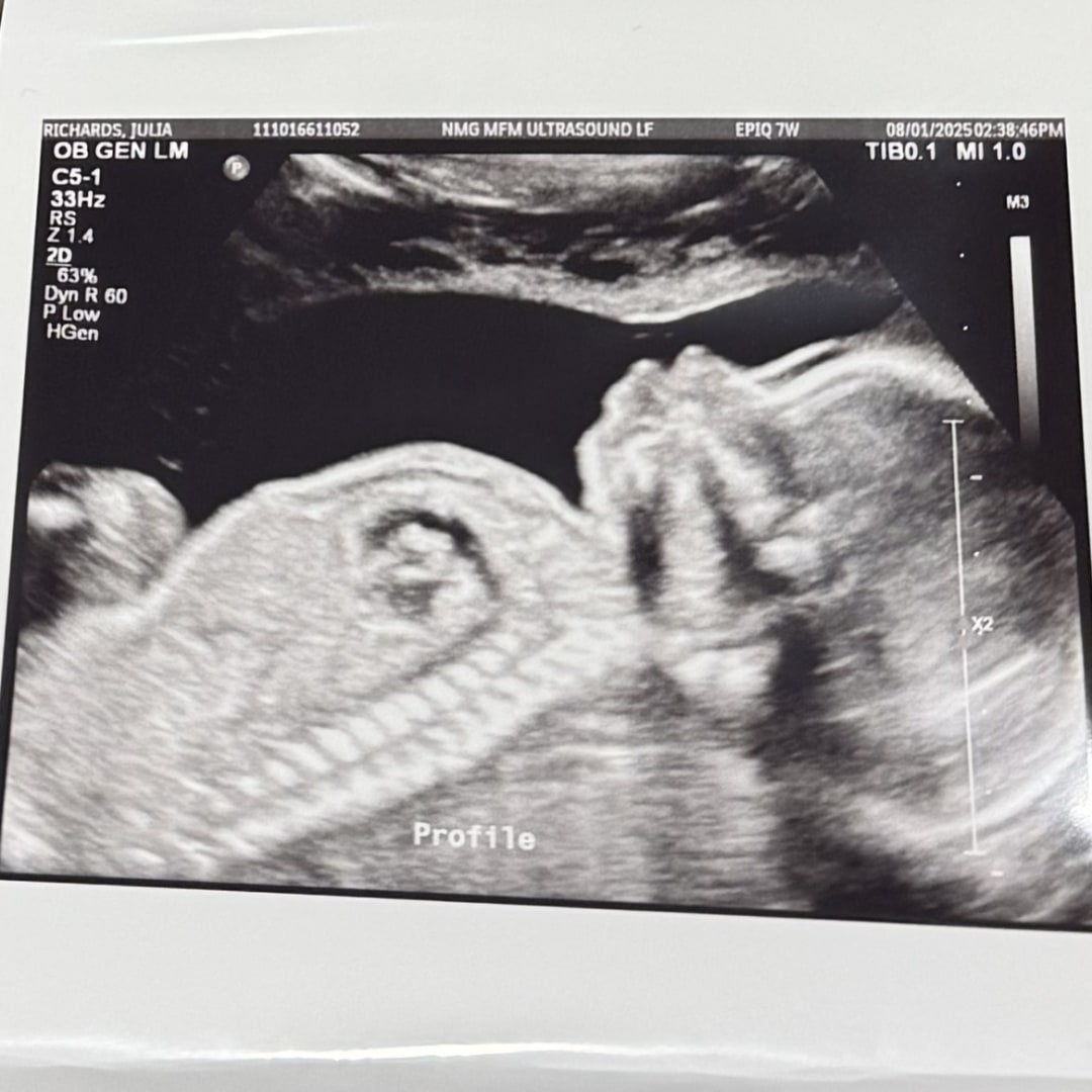 Photo shared by Julia for their Babylist baby registry.
