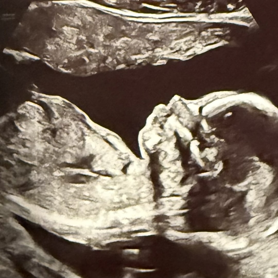 Photo shared by Madison for their Babylist baby registry.