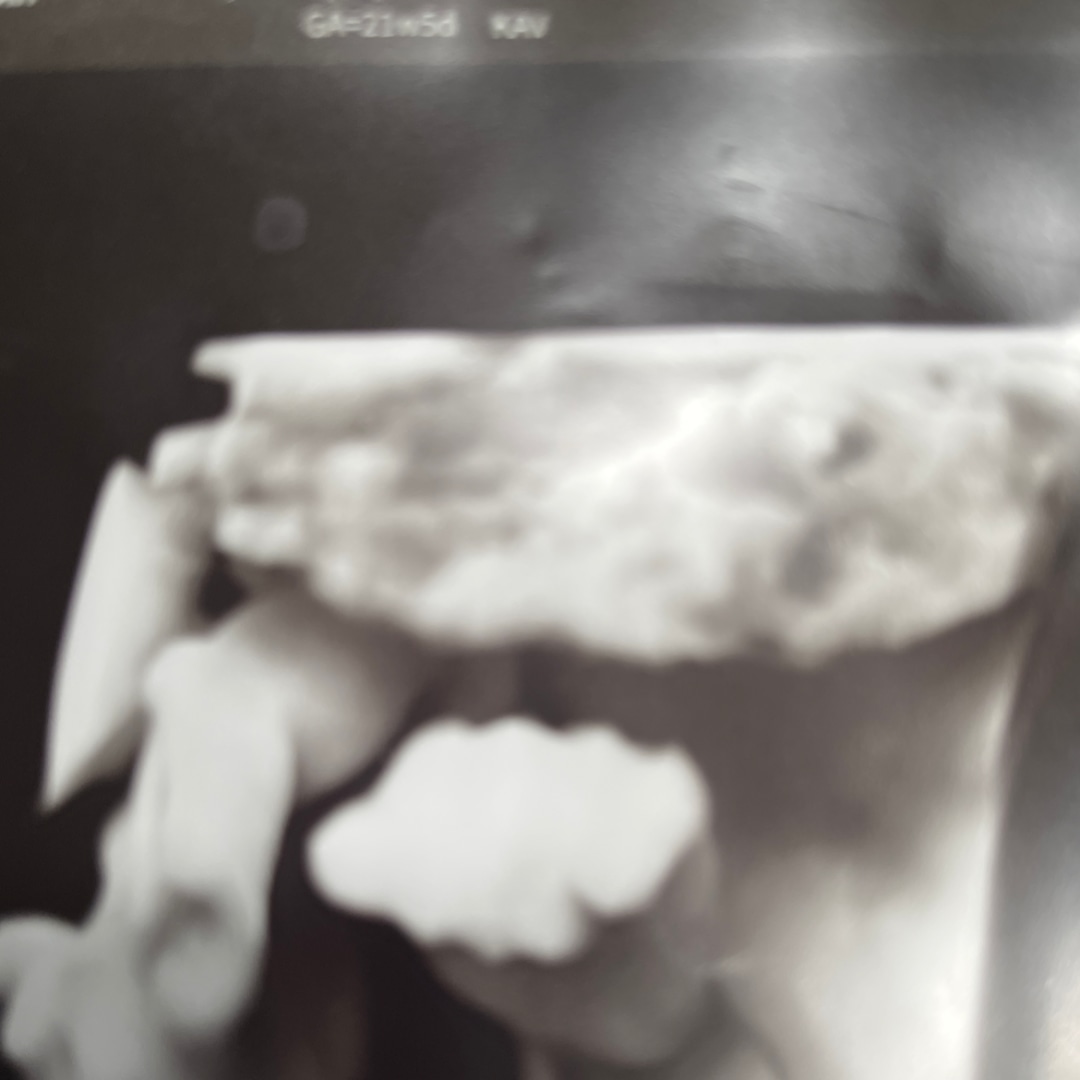 Photo shared by Aaliyah for their Babylist baby registry.