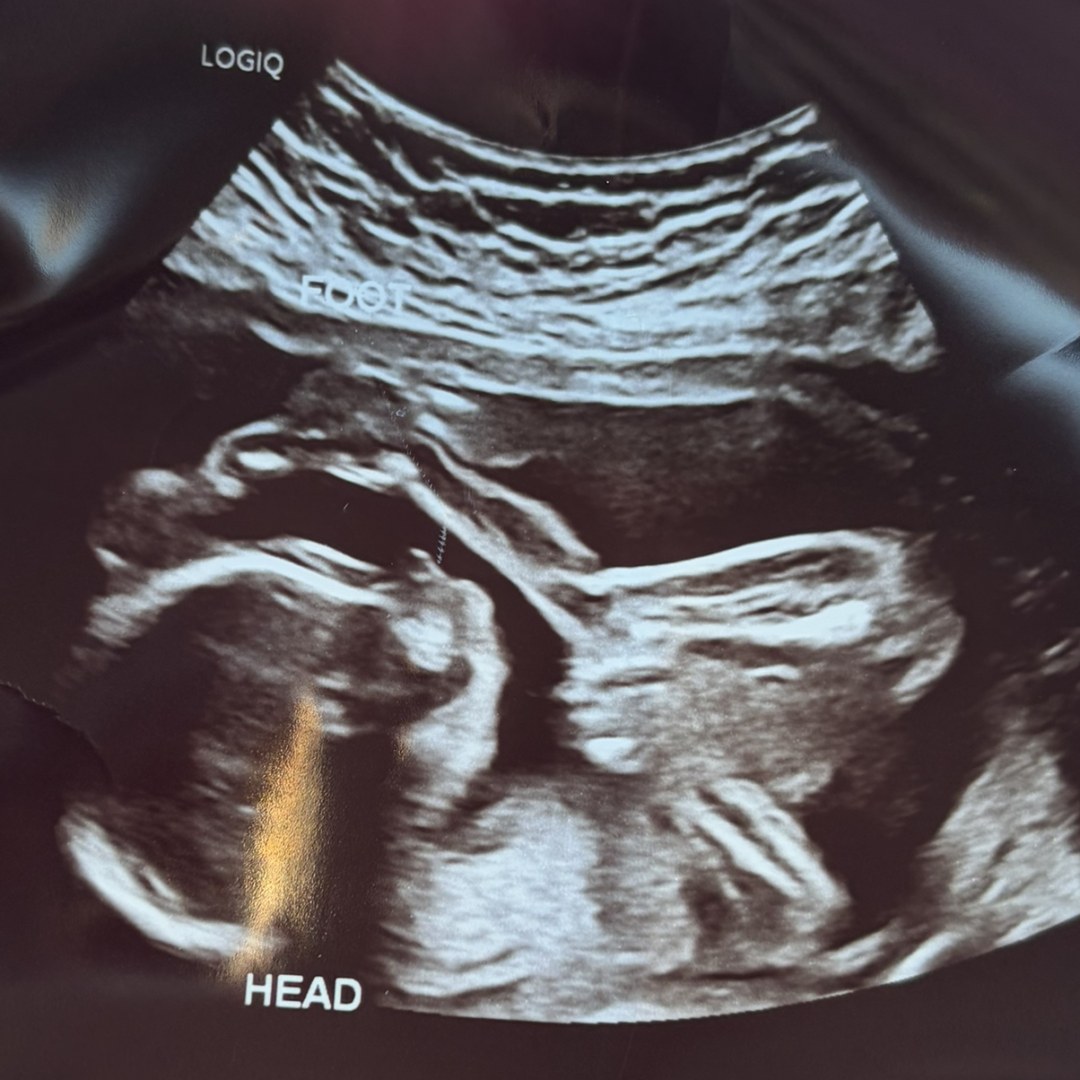 Photo shared by Noelani for their Babylist baby registry.