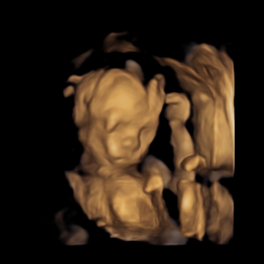 Photo shared by Emily for their Babylist baby registry.