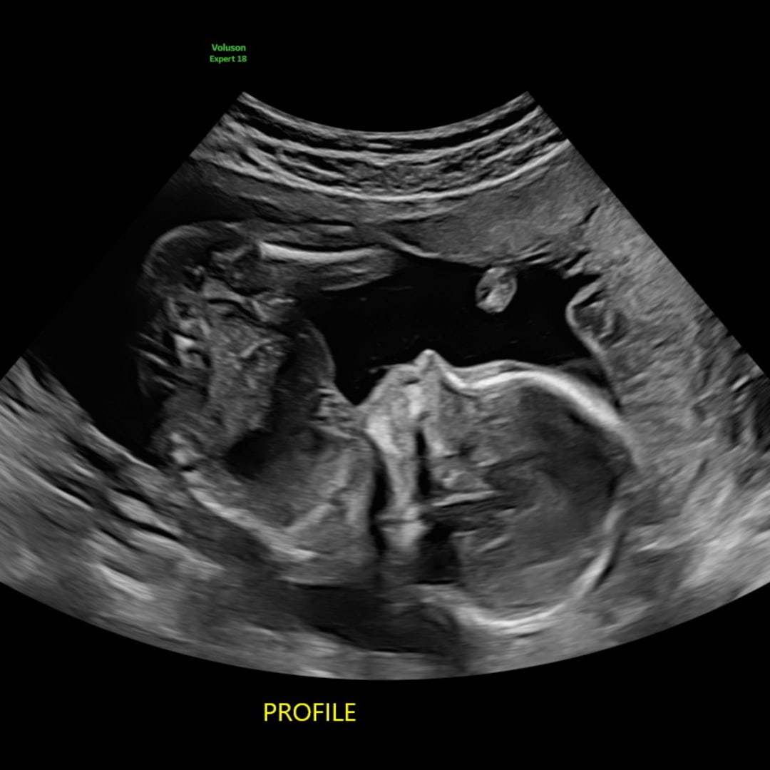 Photo shared by Paige for their Babylist baby registry.