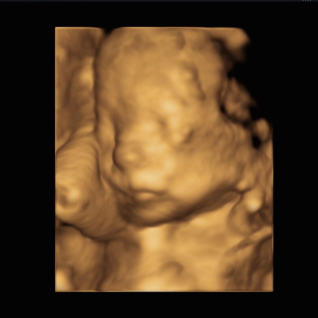 Photo shared by Erin for their Babylist baby registry.