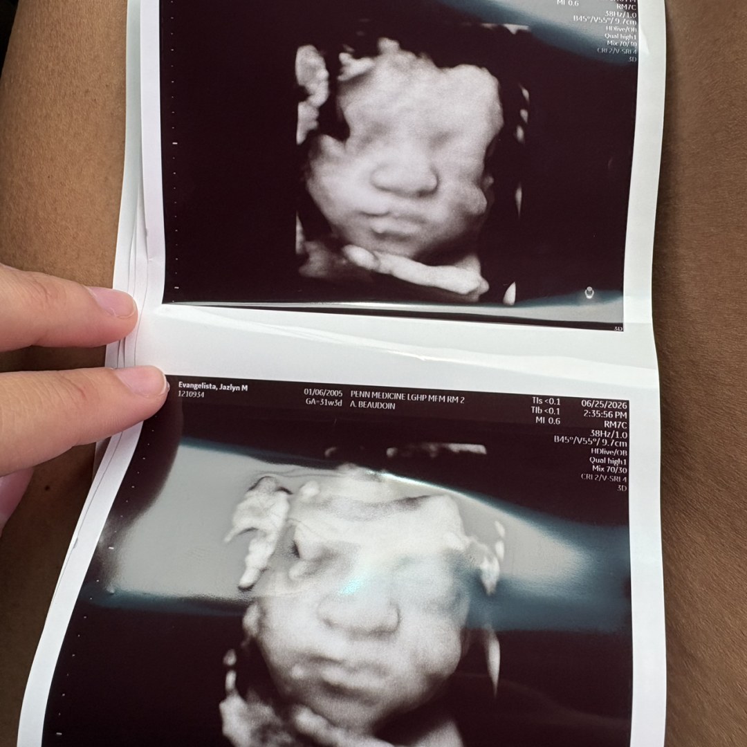 Photo shared by Jazlyn for their Babylist baby registry.