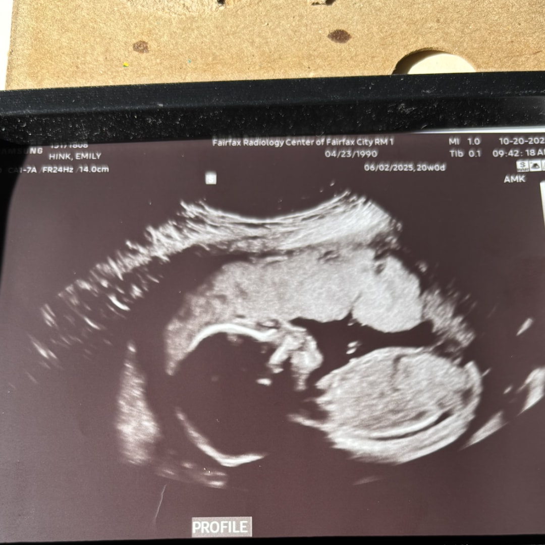 Photo shared by Emily for their Babylist baby registry.