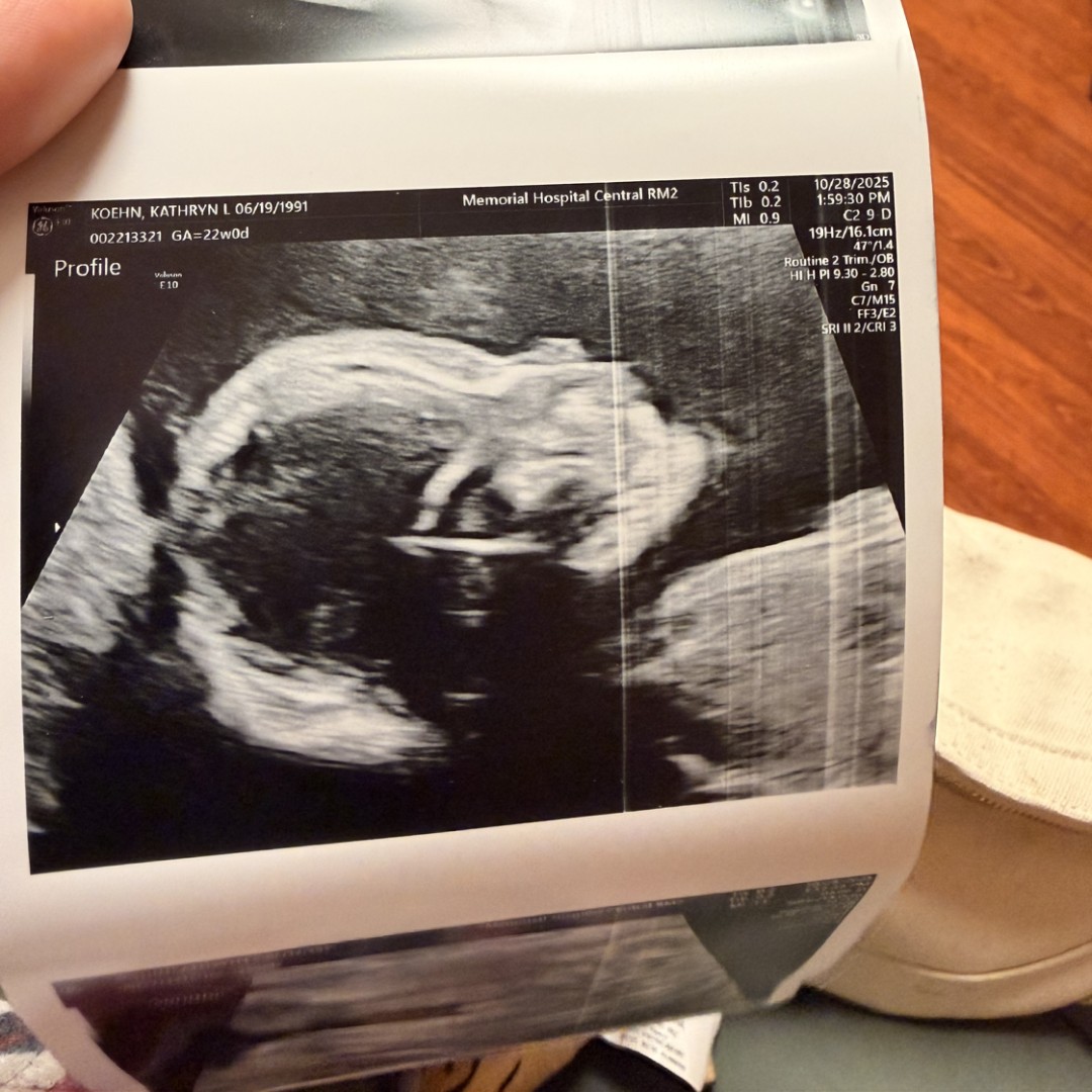 Photo shared by Kathryn for their Babylist baby registry.