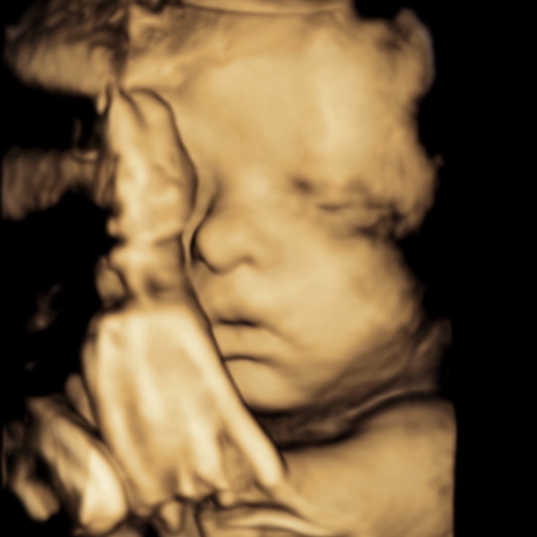 Photo shared by Katie for their Babylist baby registry.