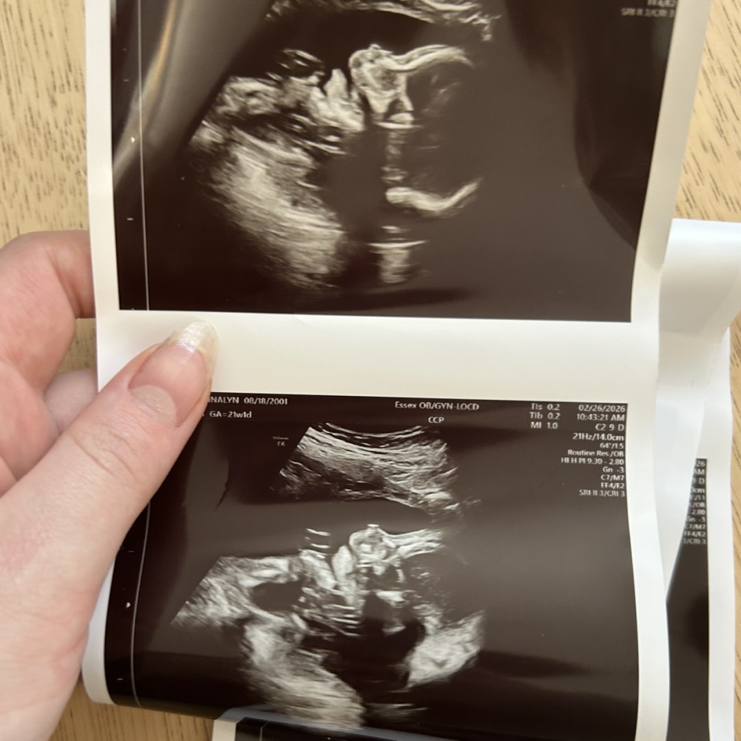 Photo shared by Jennalyn for their Babylist baby registry.