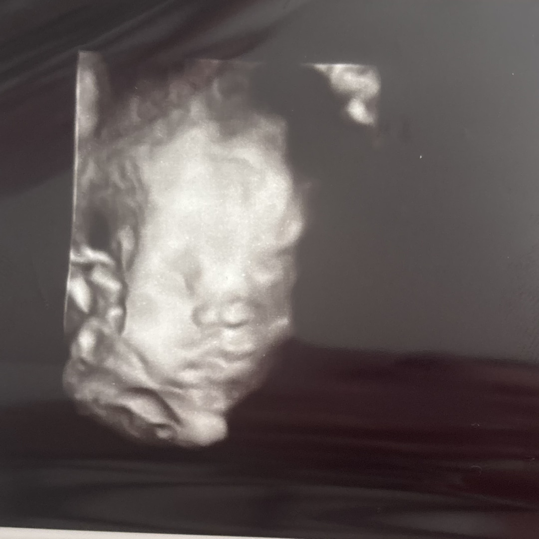 Photo shared by Grace for their Babylist baby registry.