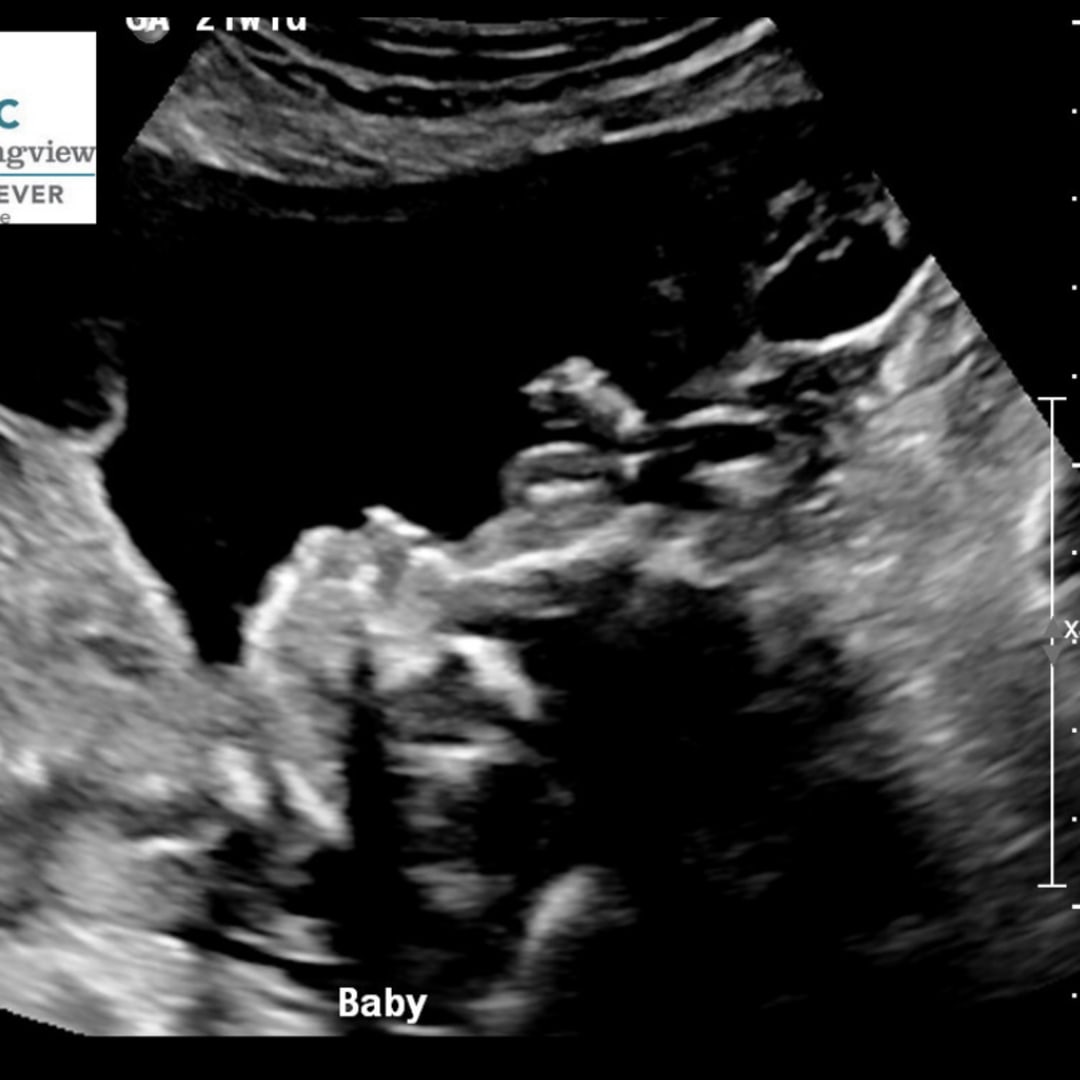 Photo shared by Rebecca for their Babylist baby registry.