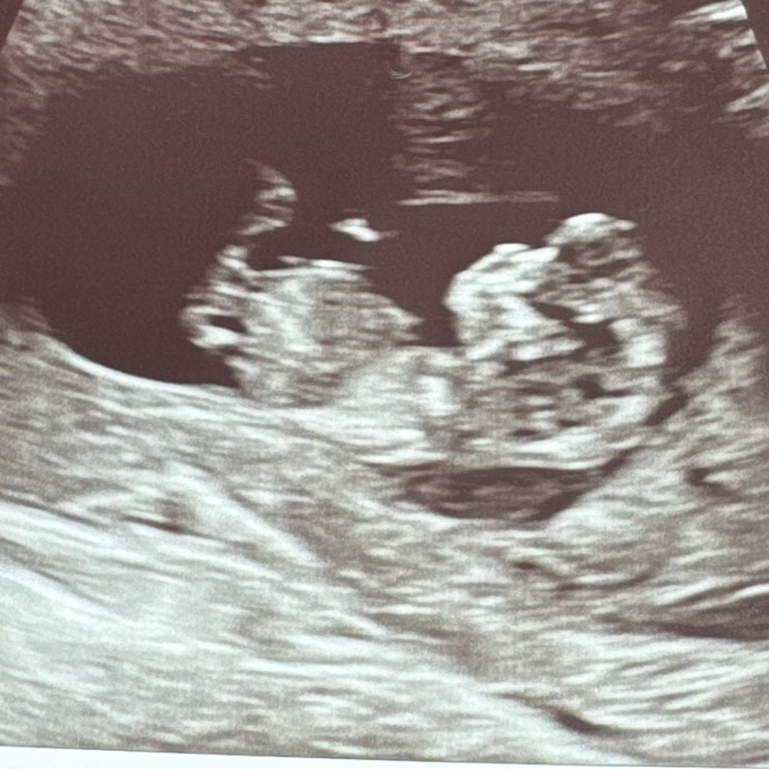 Photo shared by Brylie for their Babylist baby registry.