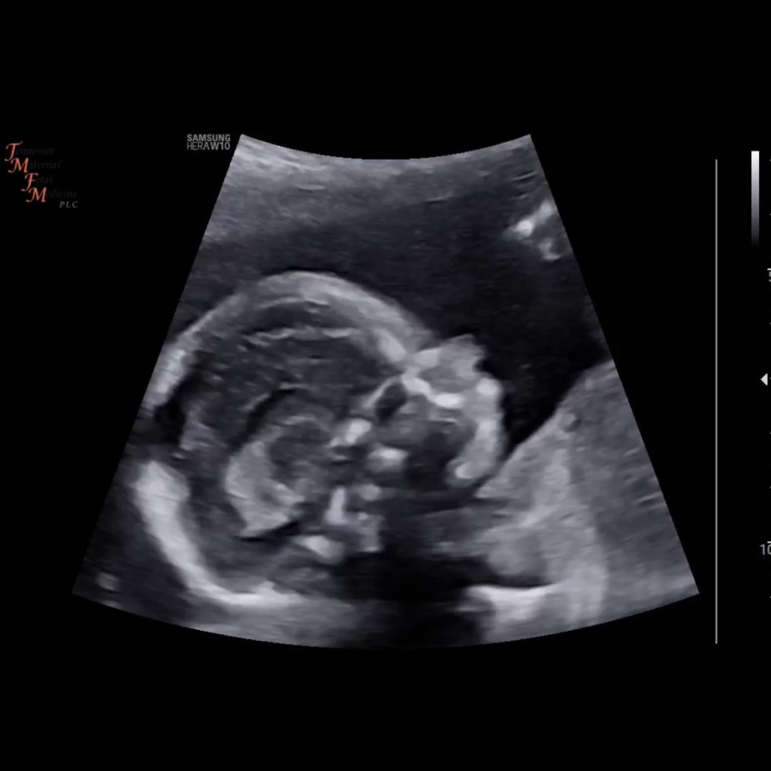Photo shared by Haley for their Babylist baby registry.