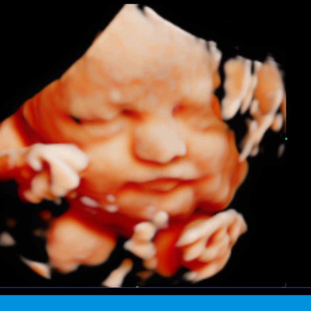 Photo shared by Kaitlyn for their Babylist baby registry.