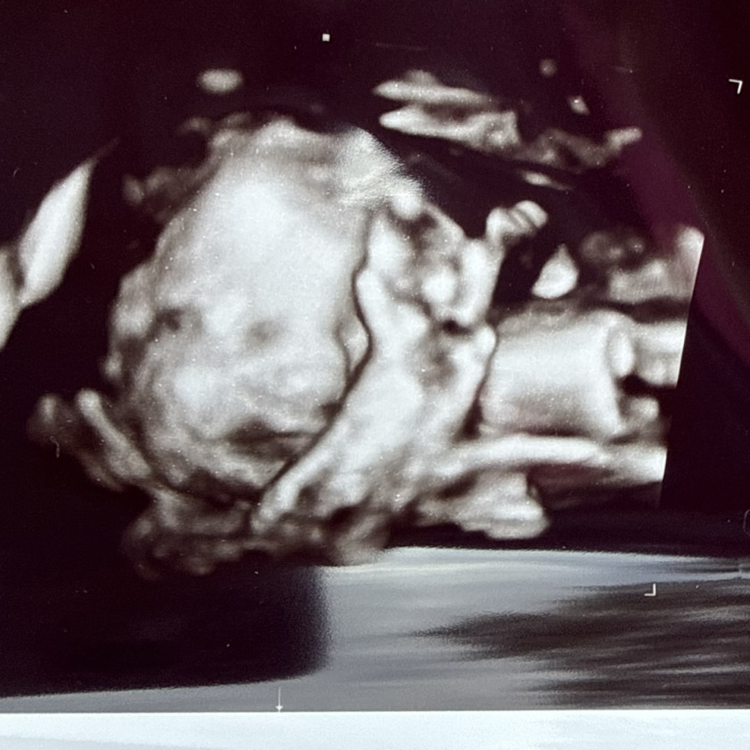 Photo shared by Grace for their Babylist baby registry.